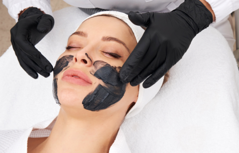 Carbon-Peel-Laser-Facial