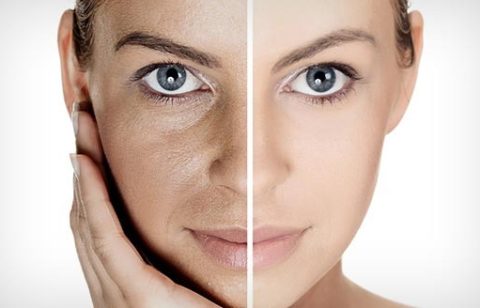facial-rejuvenation-what-is-it-a